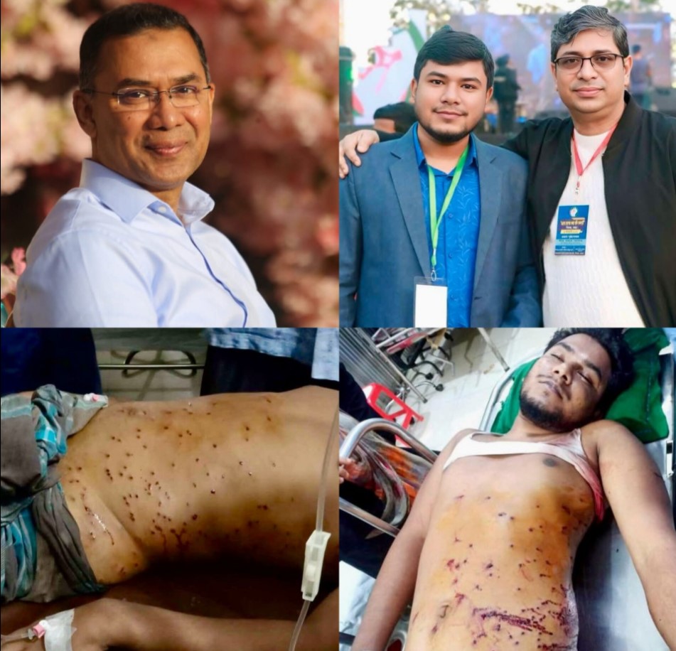 পুলিশের গুলিতে গুরুতর আহত ছাত্রদল কর্মীর সিঙ্গাপুরে সুচিকিৎসার ব্যবস্থা করা হয়।