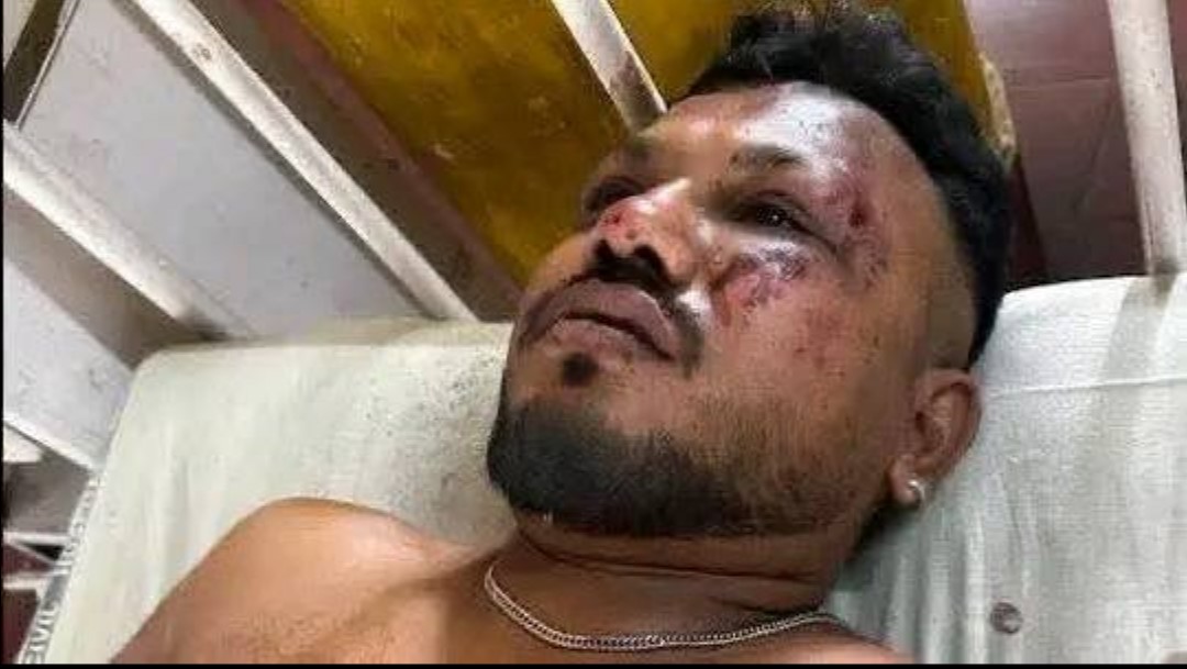 বিমান বিধ্ব স্তের বর্ণনা দিলেন বেঁচে যাওয়া একমাত্র ব্রি টিশ যাত্রী