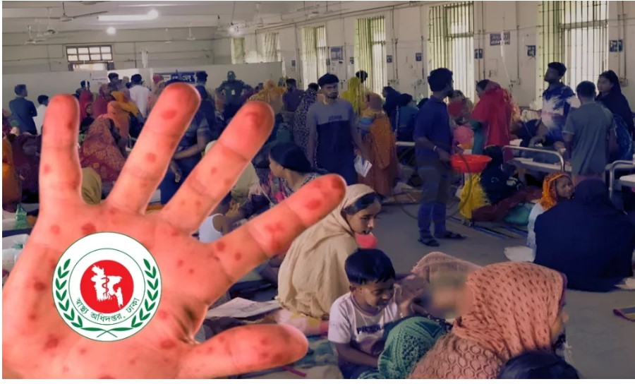 হাম ও হামের উপসর্গ নিয়ে দেশে আরও ১১ শিশুর মৃত্যু